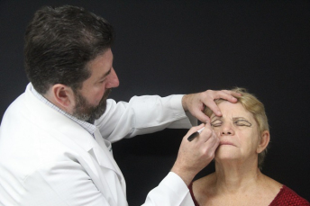 Notícia - Clínica recebe idosos para cirurgias de blefaroplastia