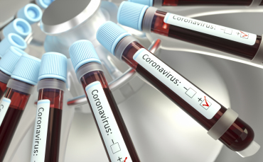 Notícia - Covid-19: um paciente, dois testes e dois resultados diferentes