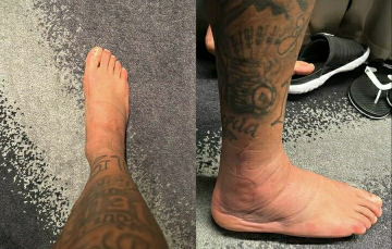 Notícia - Fora da primeira fase, Neymar compartilha recuperação do tornozelo