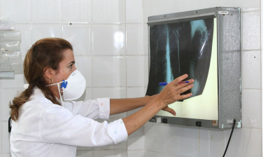 Notícia - Brasil registra 78 mil novos casos de tuberculose